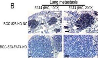 Knockout Validated: FAT4 Antibody [FITC] [NBP1-78381F] - Representative images show IHC staining with anti-FAT4 antibody (NBP1-78381F) of lung sections from BGC-823-FAT4-KO and BGC-823-KO-NC group mice. FAT4 is positive staining in the lung metastatic tumor nodules of BGC-823-KO-NC group, whereas it negative expresses in BGC-823-FAT4-KO group. Scale bar, 100 um. Image collected and cropped by CiteAb from the following publication (//pubmed.ncbi.nlm.nih.gov/29435168/) licensed under a CC-BY license.